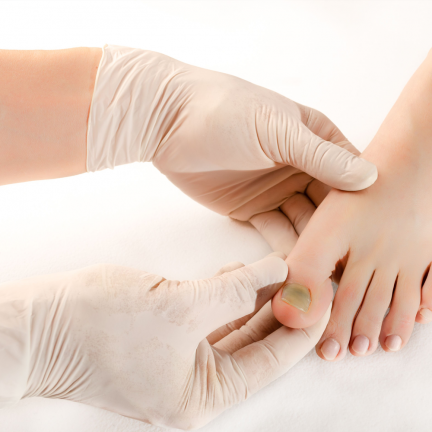 nagelpilz-behandlung